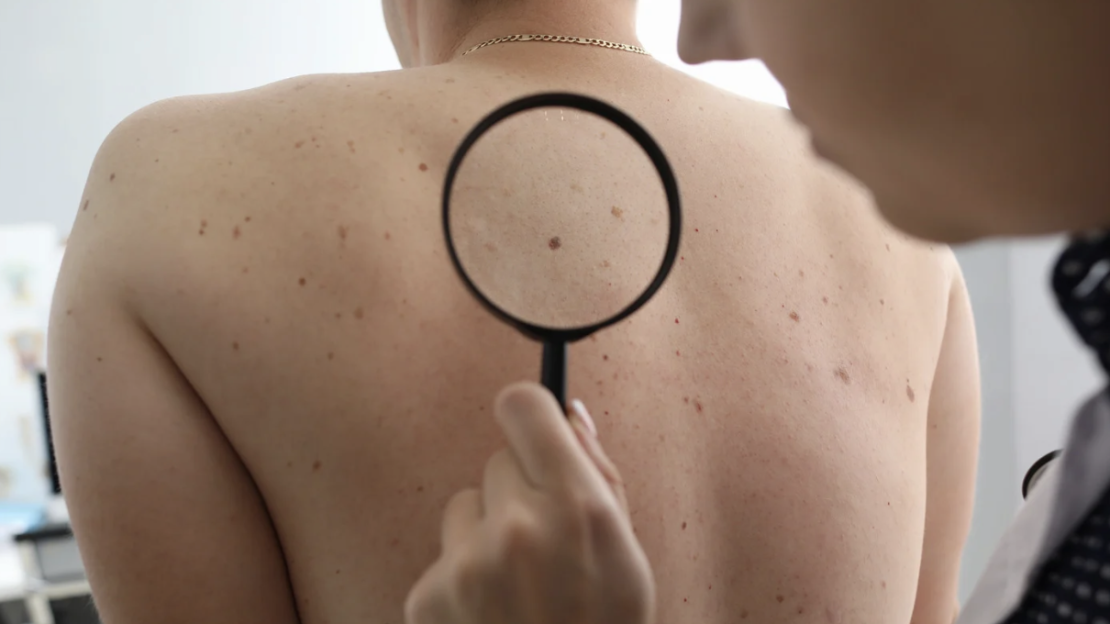 Urgent Dermatology Visit Near Calvert County